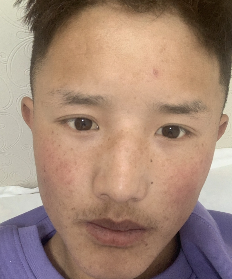 头像